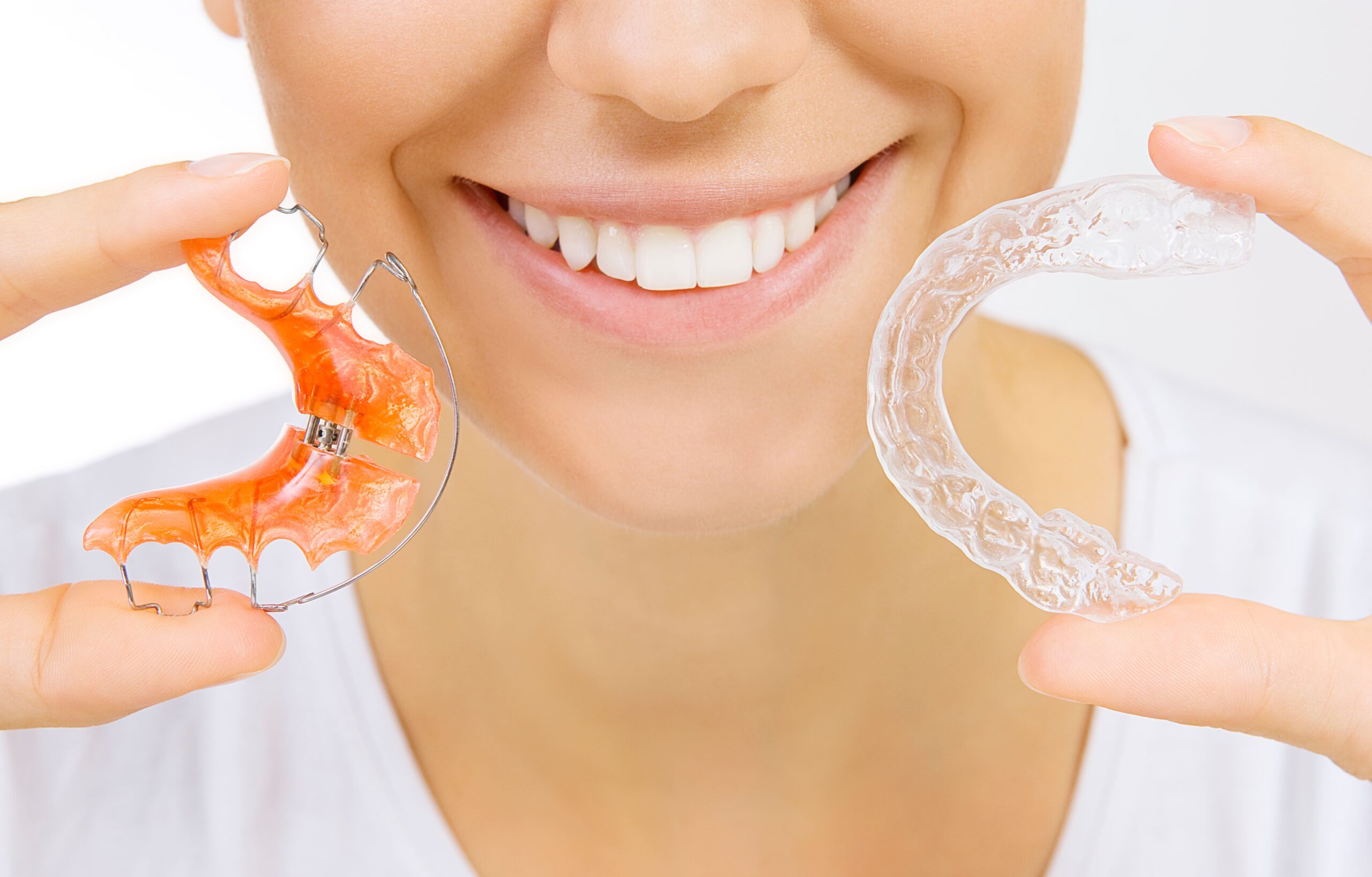 retainers after braces decatur ga