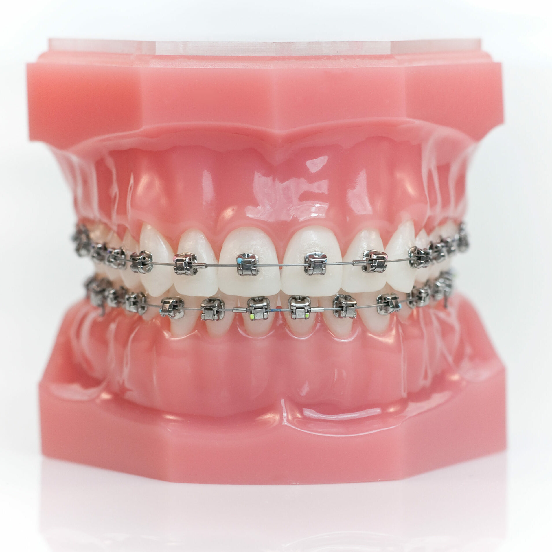 Are Clear Braces and Clear Aligners the Same? - Family Choice Dental  Albuquerque New Mexico